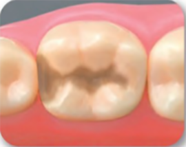 ① 形を整え終えた状態