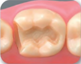 ① 形を整え終えた状態