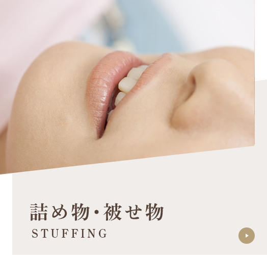 詰め物･被せ物 STUFFING